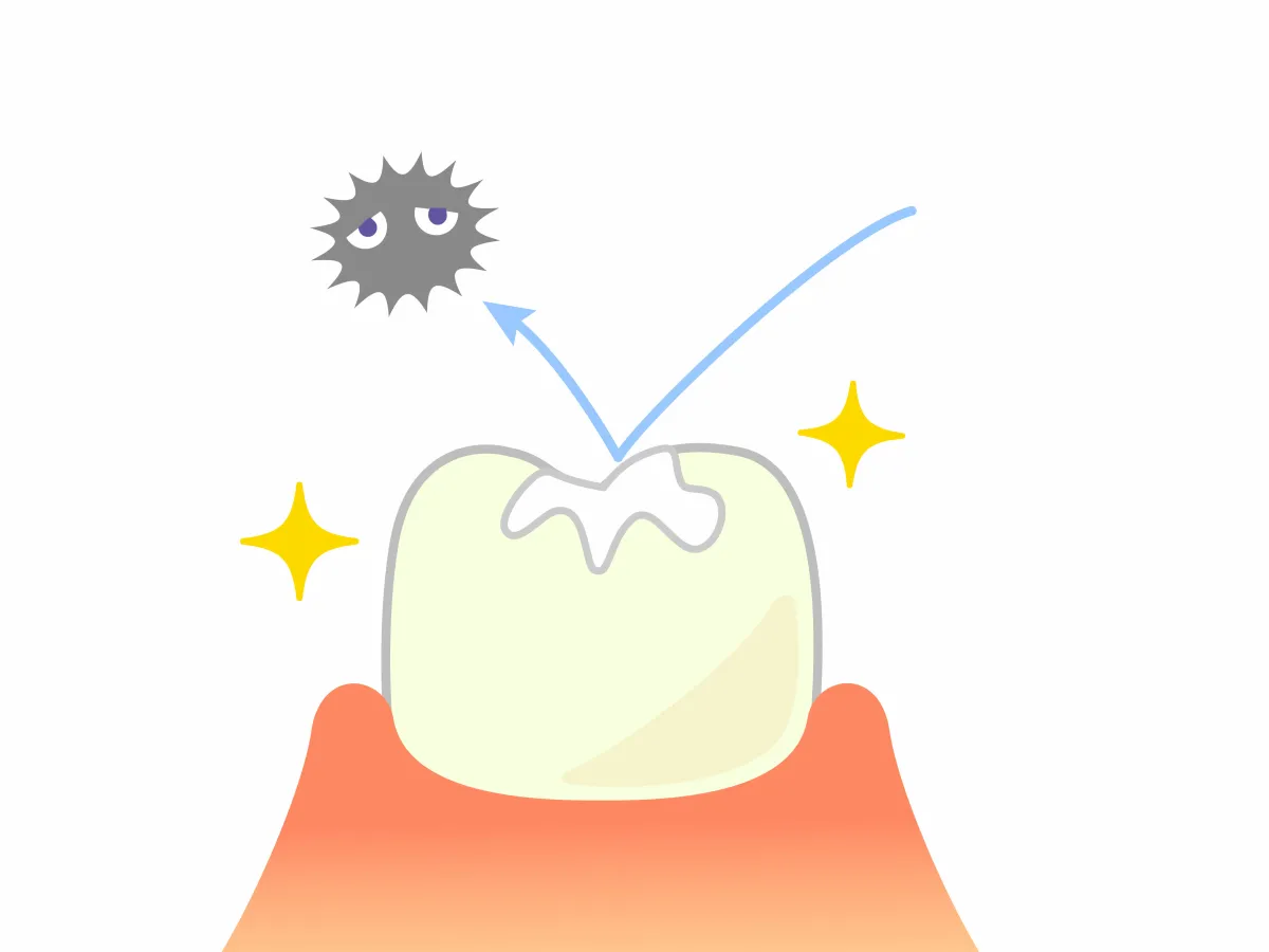 dental sealants
